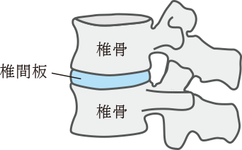 正常な椎間板
